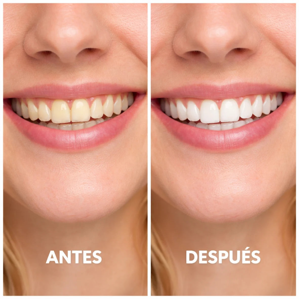 SUNNYSMILE™ – Bringe dein Lächeln in nur 30 Minuten zum Strahlen