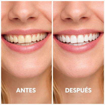 SUNNYSMILE™ – Bringe dein Lächeln in nur 30 Minuten zum Strahlen