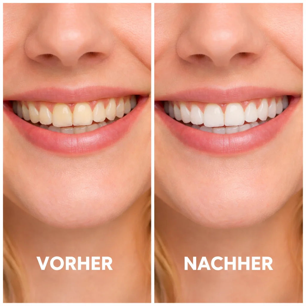 SUNNYSMILE™ – Bringe dein Lächeln in nur 30 Minuten zum Strahlen