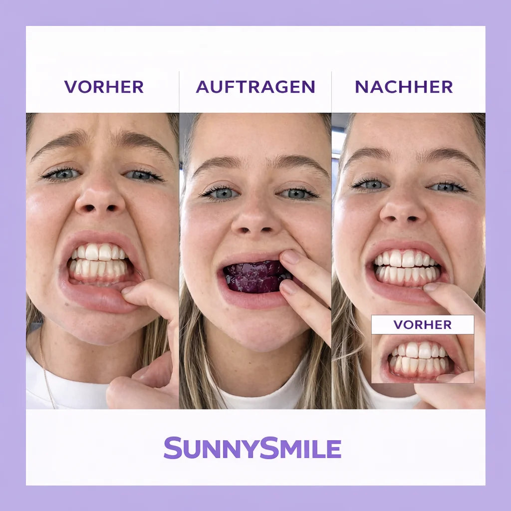 SUNNYSMILE™ – Bringe dein Lächeln in nur 30 Minuten zum Strahlen